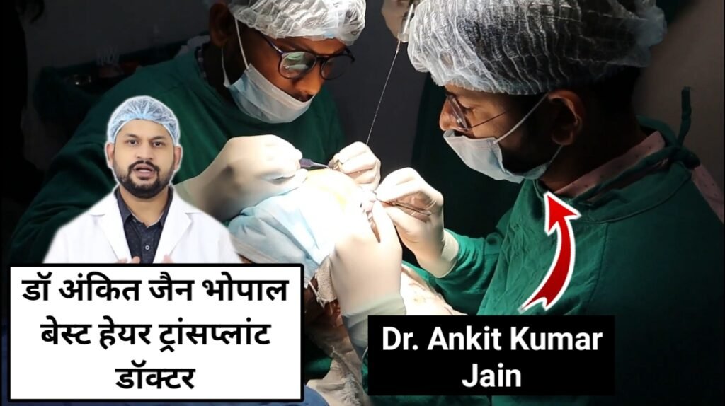 Hair Transplant in Bhopal Dr. Ankit Kumar Jain Bhopal